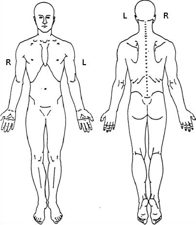 Body Diagram